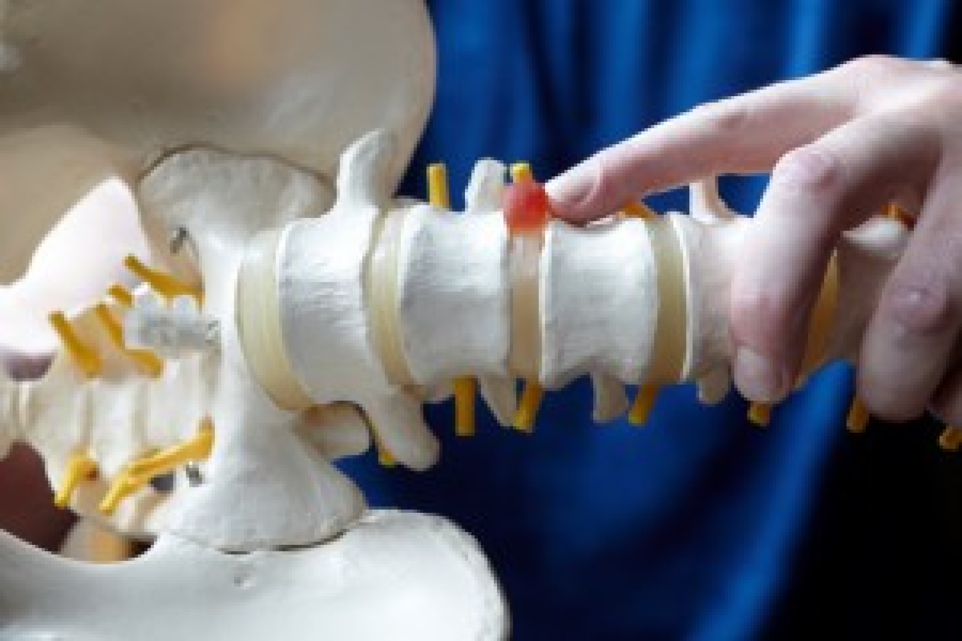  Can a chiropractor treat me without adjusting me? image