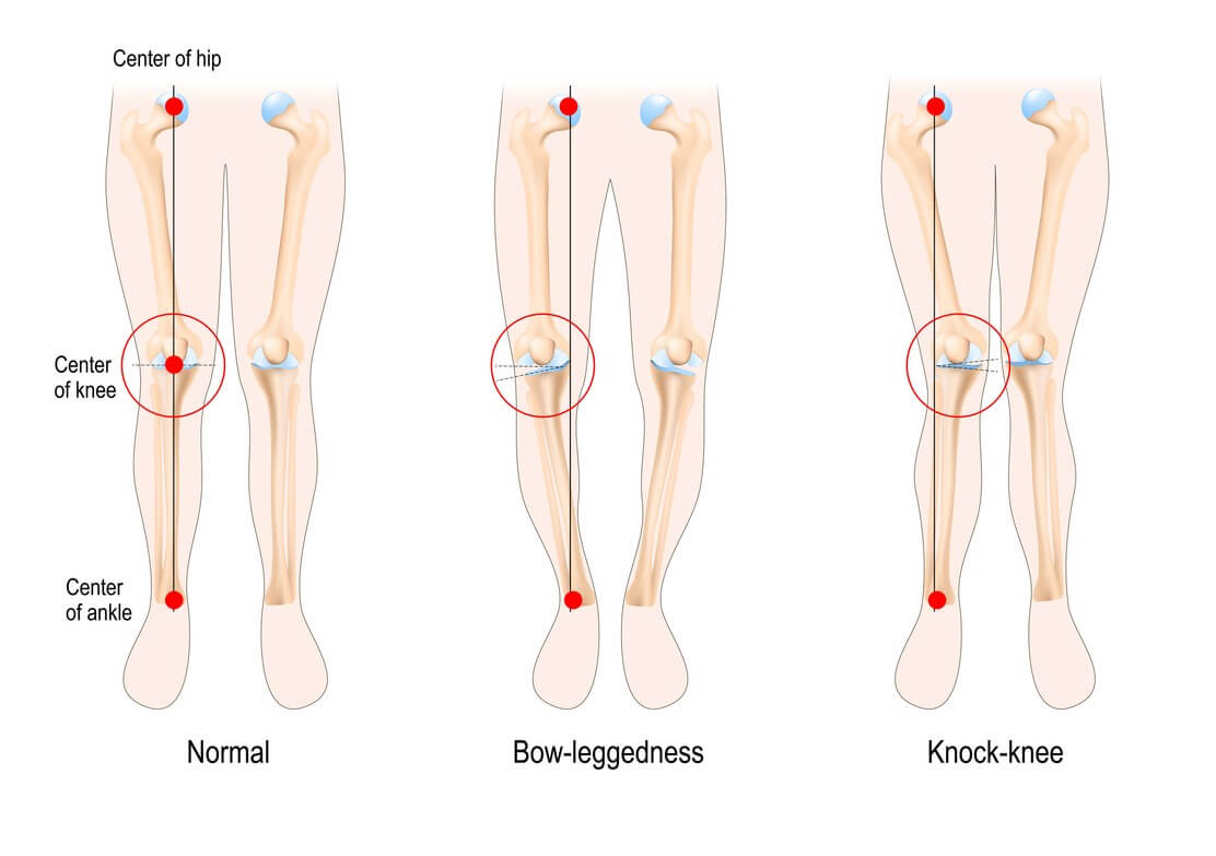 What your knee position says about your body