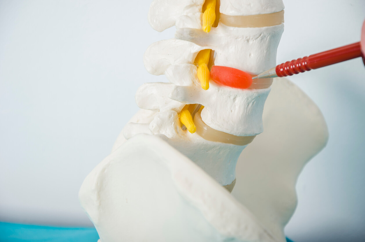 Guide to strong discs for a healthy spine