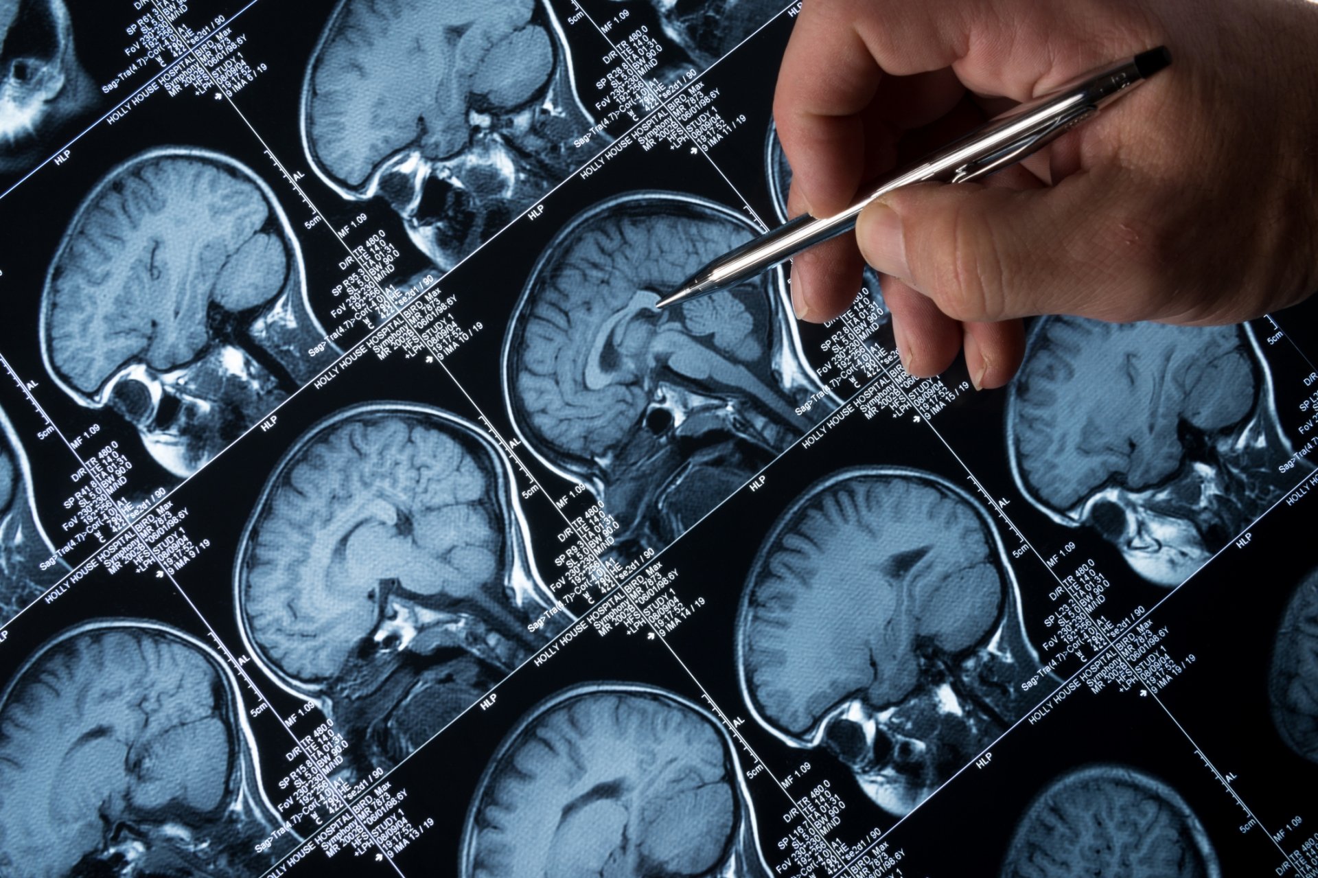 <b> Neurological Rehabilitation</b><div><br></div>