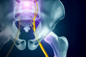 Sciatica Relief: are you on the right path?